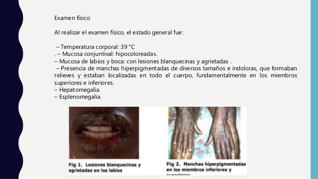 Exámenes Físicos Homosexuales Anciano Exámenes físicos homosexuales anciano
